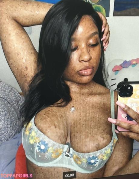 Freckledn nude leaked OnlyFans photo #2