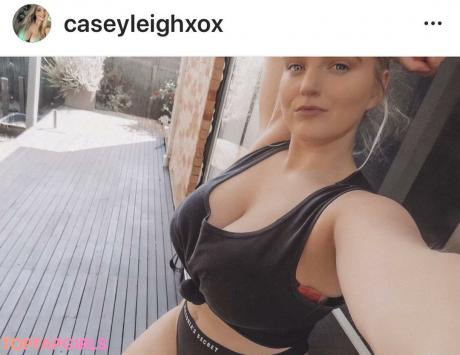 Casey nude leaked OnlyFans photo #495