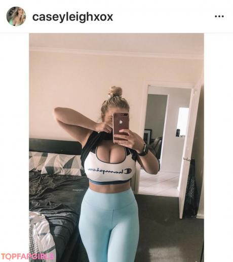 Casey nude leaked OnlyFans photo #78
